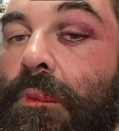 Homem é agredido após reclamar de som alto em igreja de SC